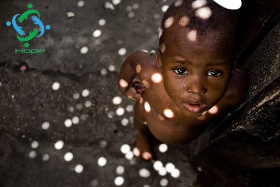 HOPE : Groupe à vacation humanitaire
plus d'info:
https://www.facebook.com/hopegroupe
http://hopegroupe.over-blog.com/
mail :  hopersgroupe@gmail.com